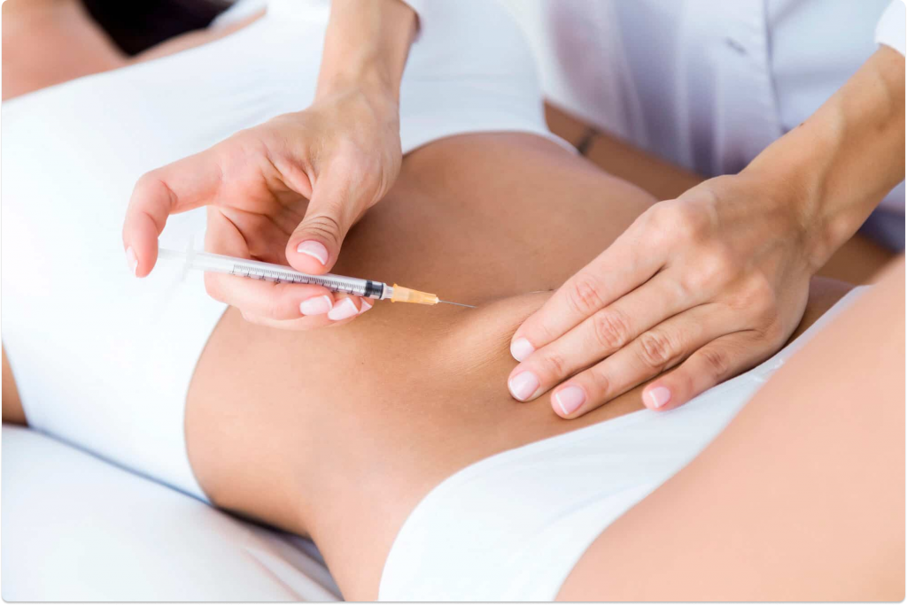 Mesoterapia